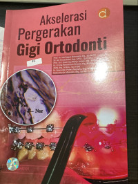 Image of akselerasi pergerakan gigi ortodonti
