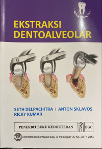 Image of Ekstraksi dentoalveolar