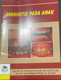 Image of gingivitas pada anak