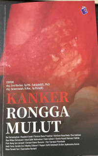 Image of Kanker rongga mulut