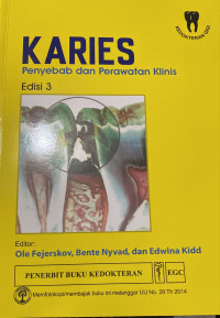 Image of Karies : Penyebab dan perawatan klinis