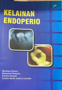 Image of Kelainan Endoperio