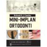 Image of mini-implan ortodonti