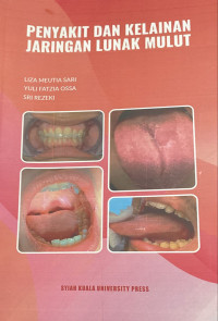 Image of Penyakit dan kelainan jaringan lunak mulut