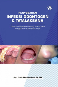 Image of penyebaran infeksi odontogen & tatalaksana