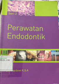 Image of Perawatan endodontik