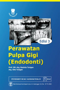 Image of Perawatan Pulpa Gigi (Endodonti)