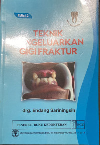 Image of Teknik mengeluarkan gigi fraktur